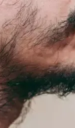 BARBA FALHADA