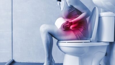 Conheça os Alimentos que Melhoram o Intestino Preso